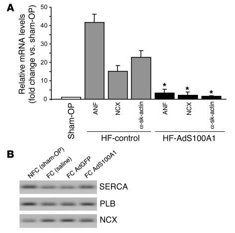 Sodium/Calcium Exchanger Antibody in Western Blot (WB)