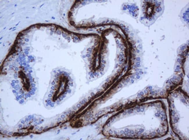 KRT5 Antibody (TA800728)