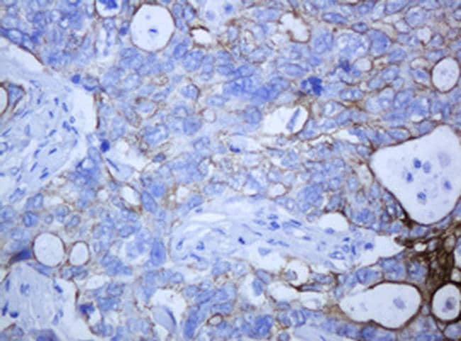 KRT5 Antibody (TA801063)