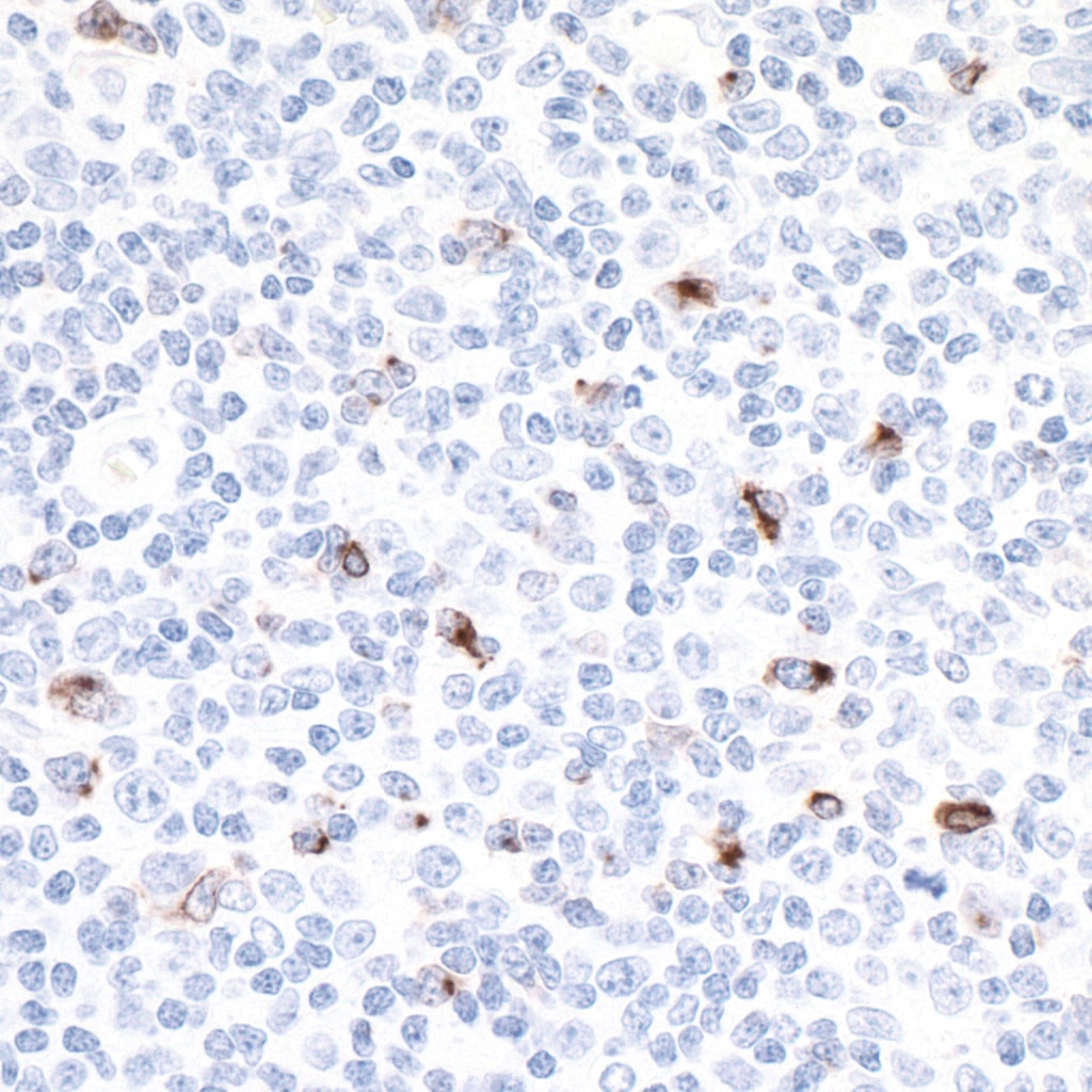 LAG3 Antibody (A700-028)