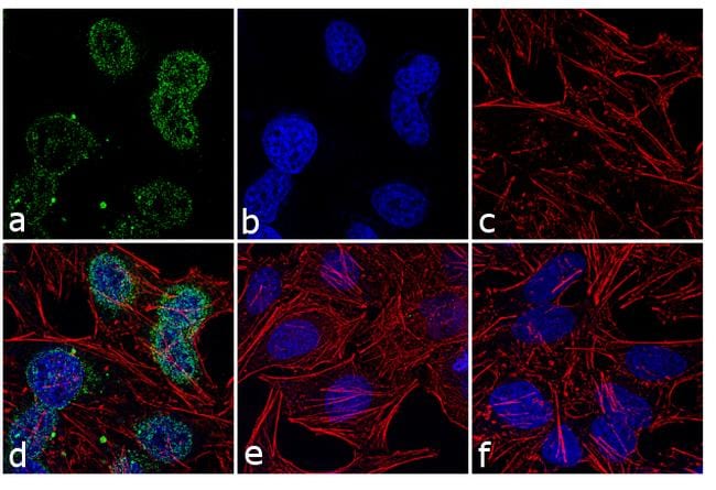 PRAK Antibody in Immunocytochemistry (ICC/IF)