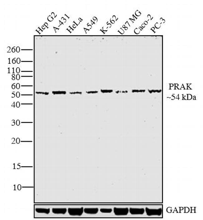 PRAK Antibody in Western Blot (WB)