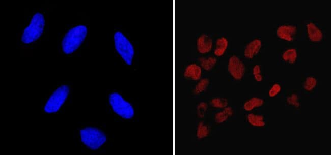 Nanog Antibody in Immunocytochemistry (ICC/IF)