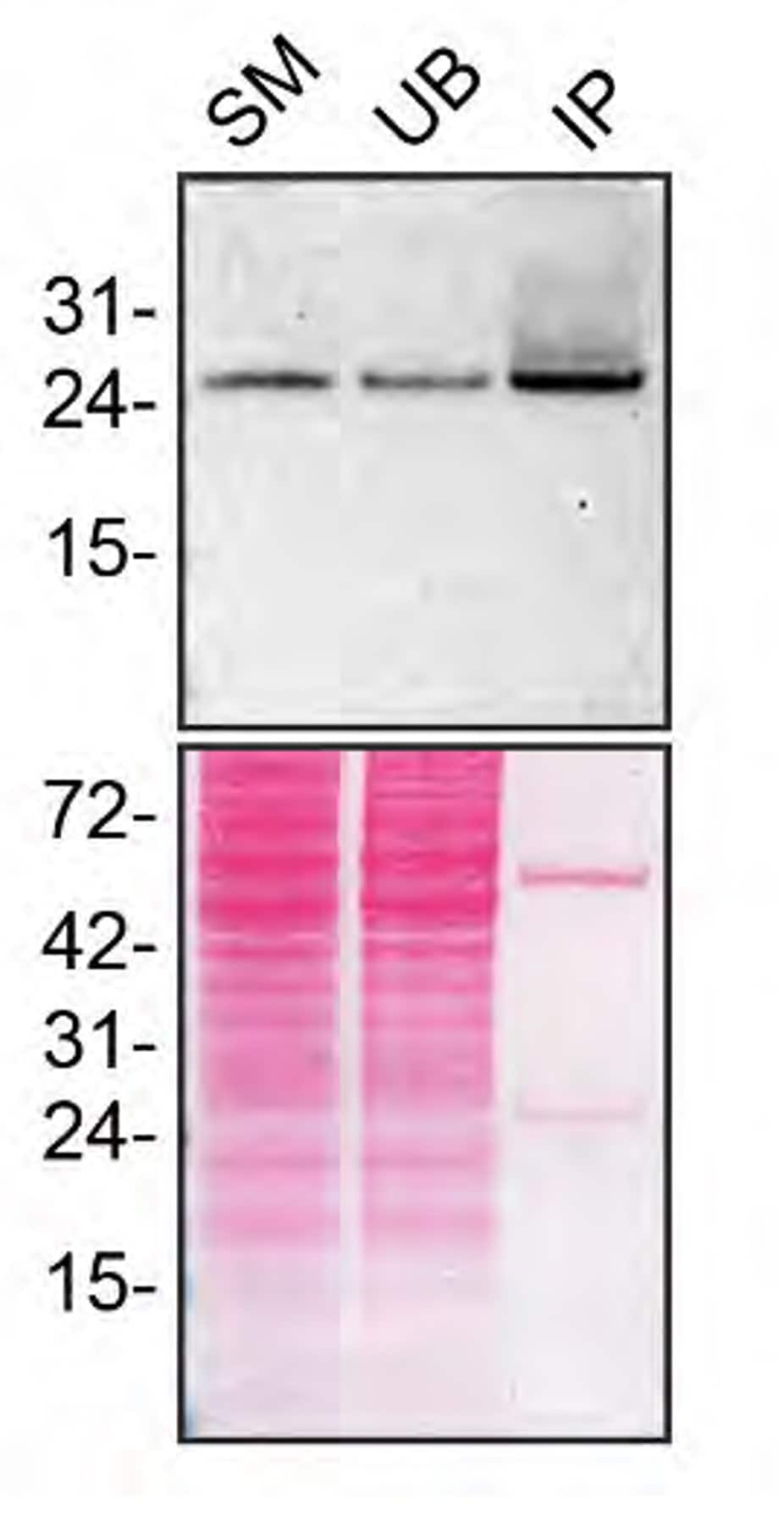 RAB27A Antibody in Immunoprecipitation (IP)