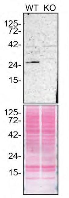 RAB27A Antibody