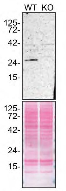 RAB27A Antibody in Western Blot (WB)