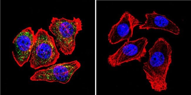 beta Catenin Antibody in Immunocytochemistry (ICC/IF)