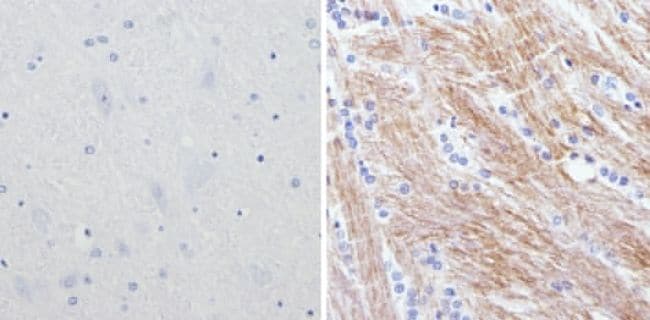 NEFM Antibody in Immunohistochemistry (Paraffin) (IHC (P))