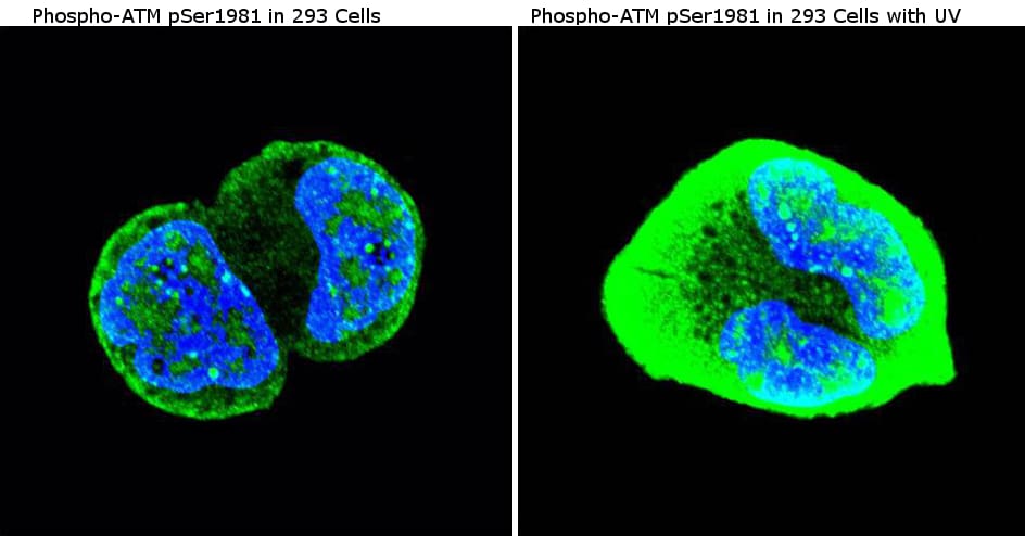 Phospho-ATM (Ser1981) Antibody (MA1-2020)