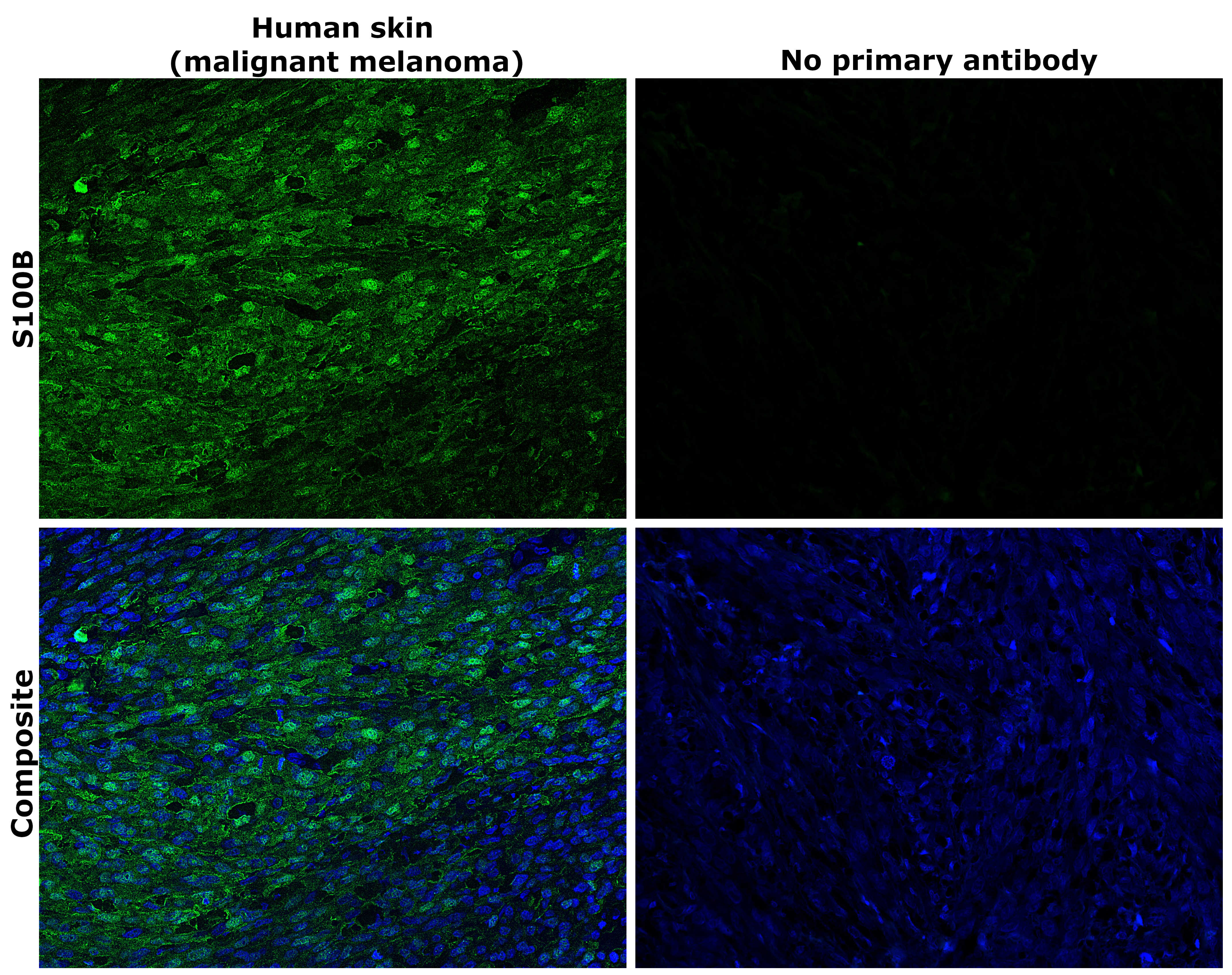 S100B Antibody in Immunohistochemistry (Paraffin) (IHC (P))