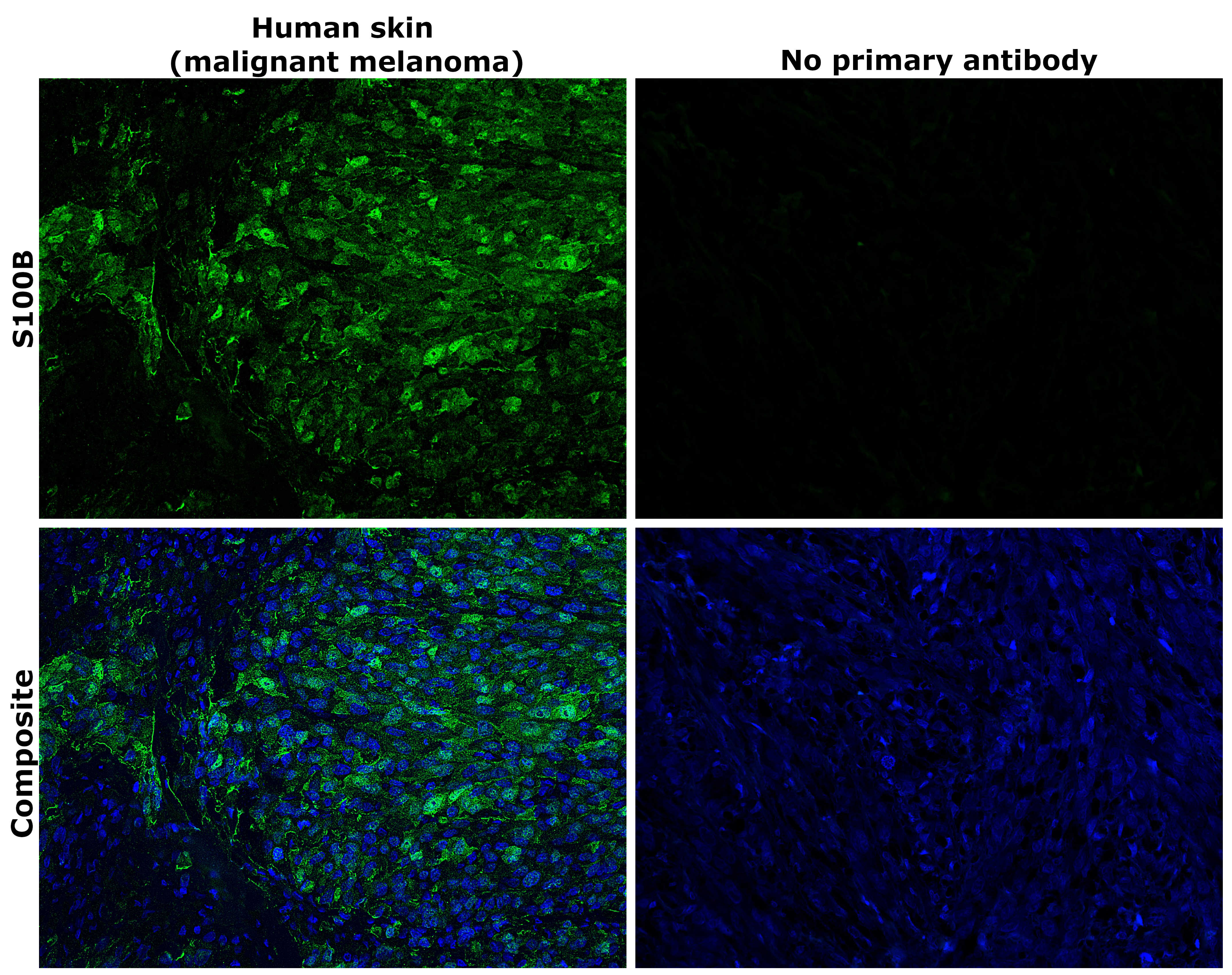 S100B Antibody in Immunohistochemistry (Paraffin) (IHC (P))