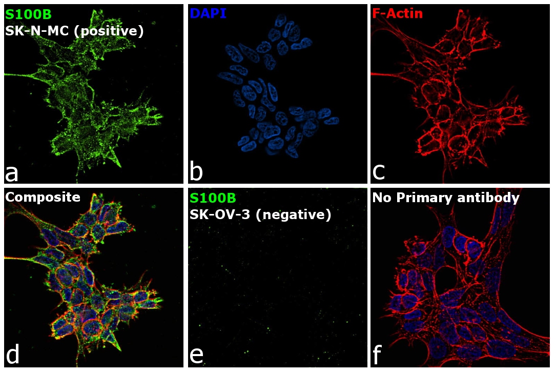 S100B Antibody