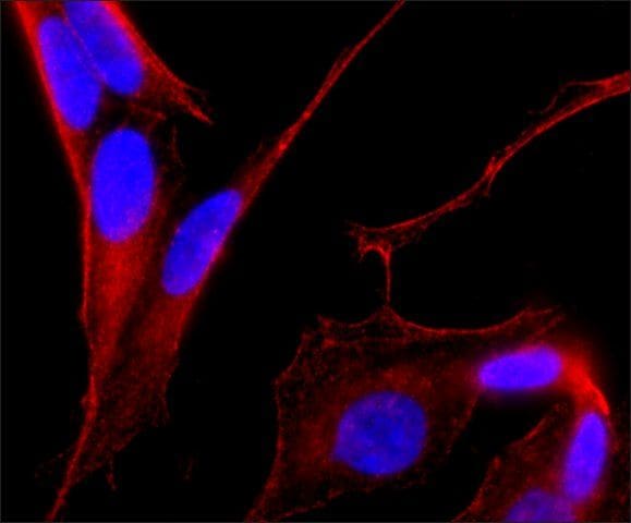 MAP2 Antibody (MA1-25044)