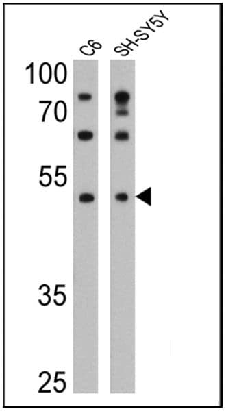 DRD5 Antibody in Western Blot (WB)