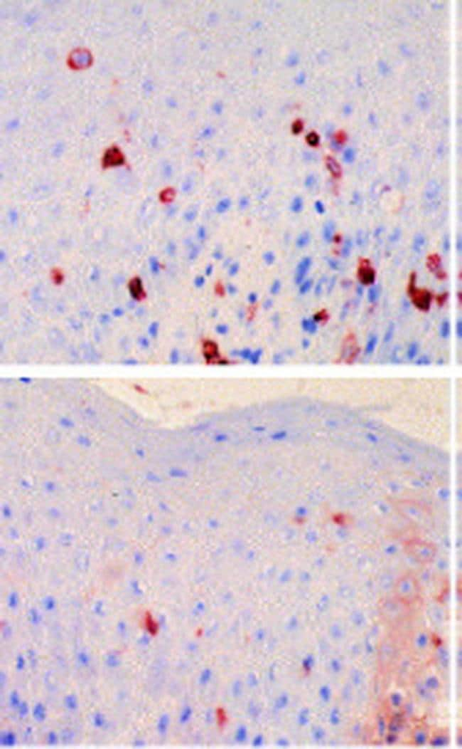 FceR1 alpha Antibody in Immunohistochemistry (Frozen) (IHC (F))