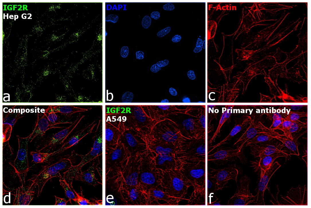 IGF2R Antibody in Immunocytochemistry (ICC/IF)