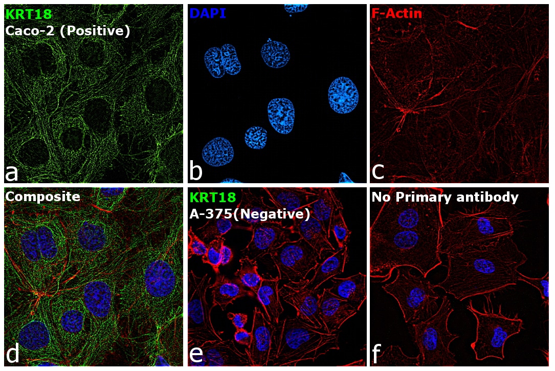 Cytokeratin 18 Antibody (MA1-19047)