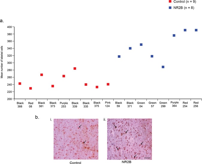 NMDAR2B Antibody in Immunohistochemistry (IHC)