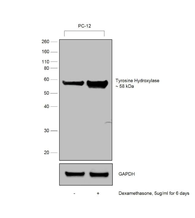 Tyrosine Hydroxylase Monoclonal Antibody (185)