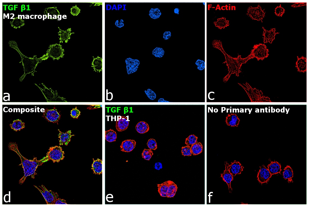 TGF beta-1 Antibody