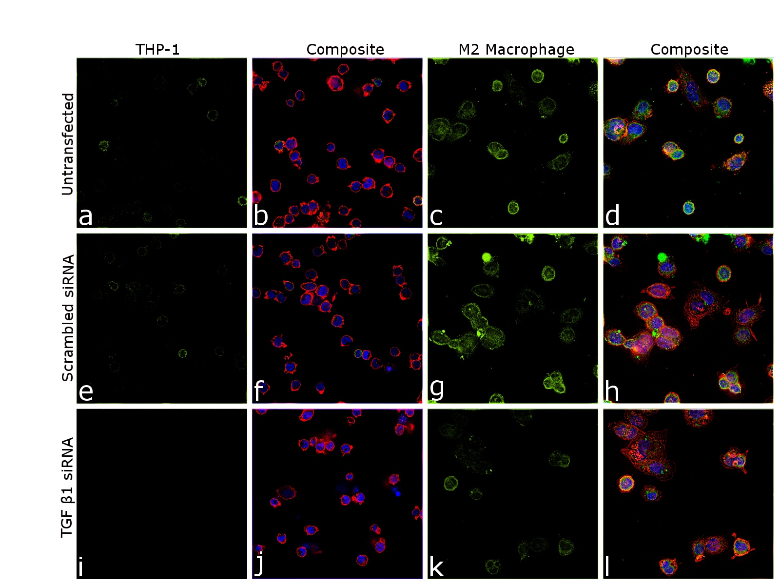 TGF beta-1 Antibody