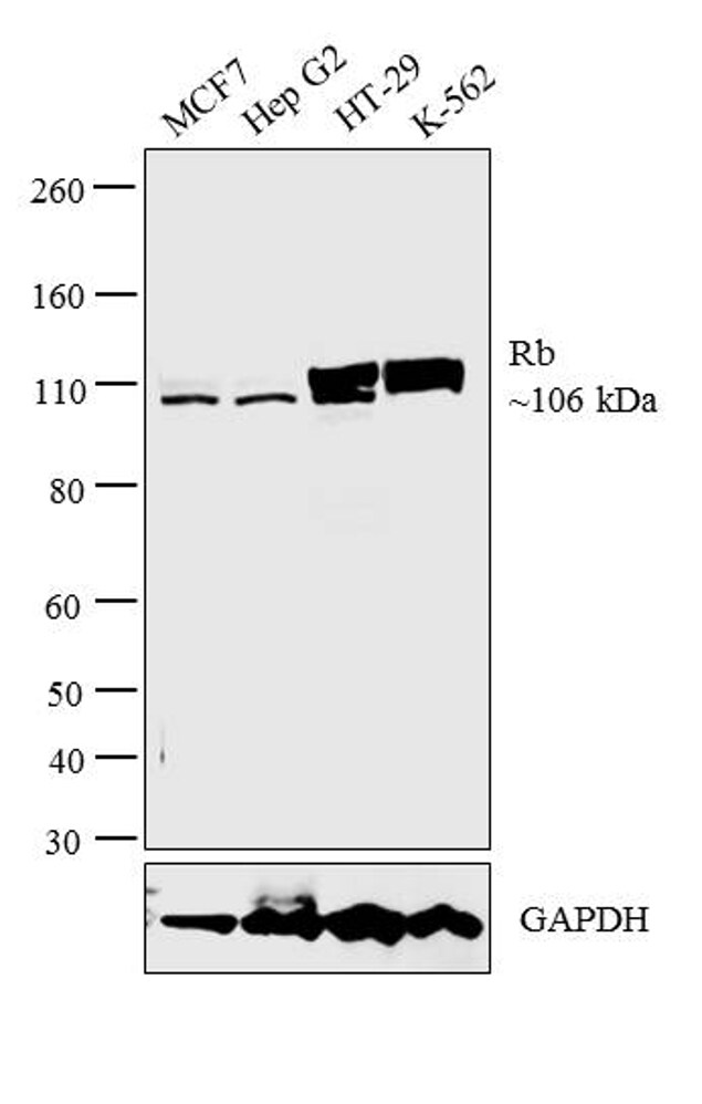 Rb Antibody in Western Blot (WB)