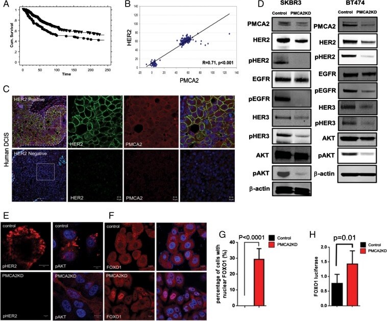 PMCA2 ATPase Antibody in Immunocytochemistry (ICC/IF)