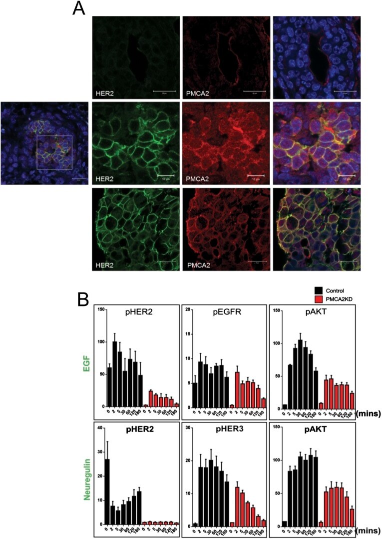 PMCA2 ATPase Antibody in Immunocytochemistry (ICC/IF)