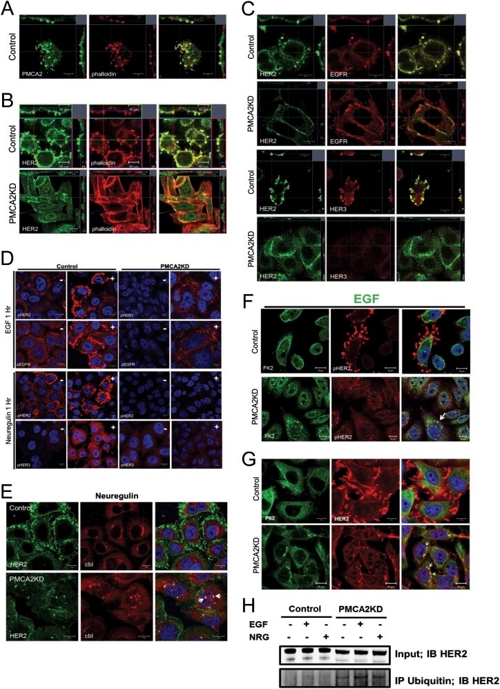 PMCA2 ATPase Antibody in Immunocytochemistry (ICC/IF)