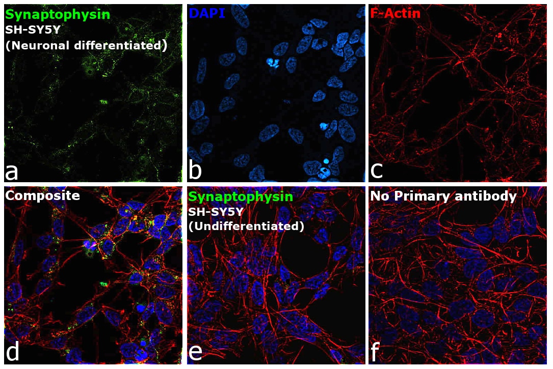 Synaptophysin Antibody