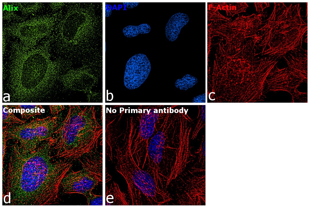 Alix Antibody in Immunocytochemistry (ICC/IF)