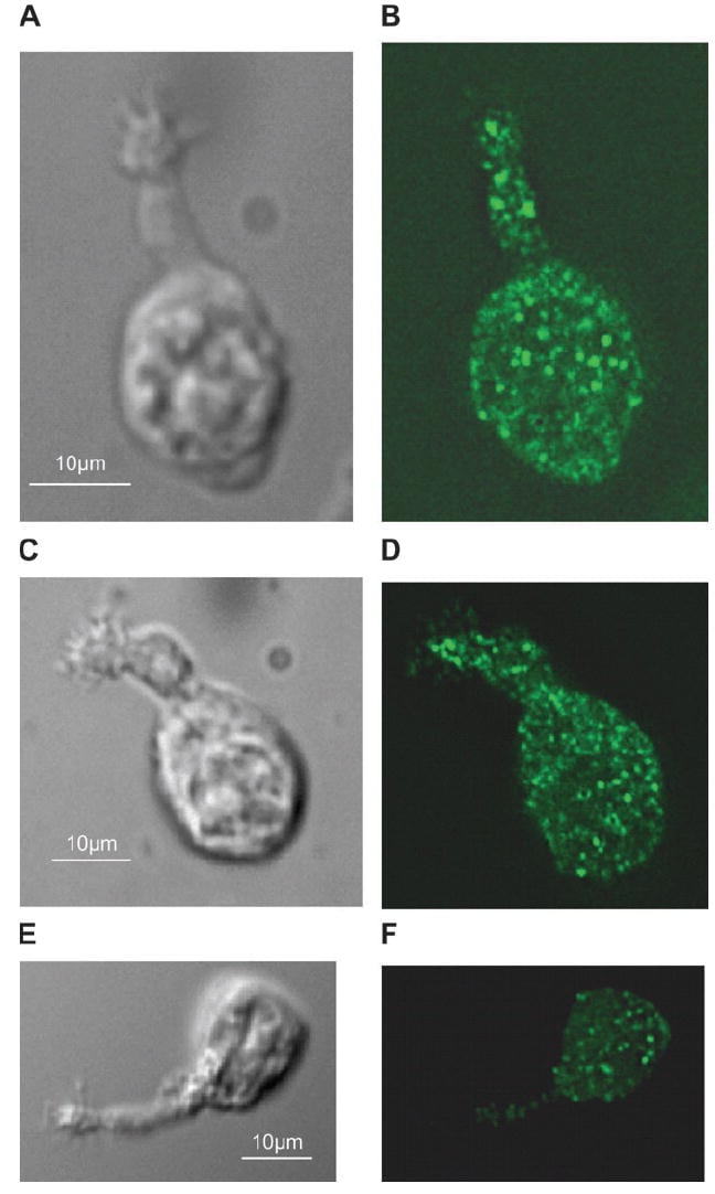 PMCA2 ATPase Antibody in Immunocytochemistry (ICC/IF)