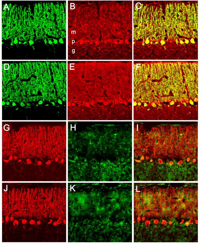 PMCA4 ATPase Antibody in Immunocytochemistry, Immunohistochemistry (ICC/IF, IHC)