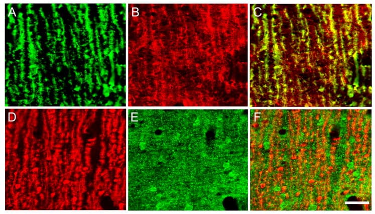 PMCA4 ATPase Antibody in Immunohistochemistry (IHC)