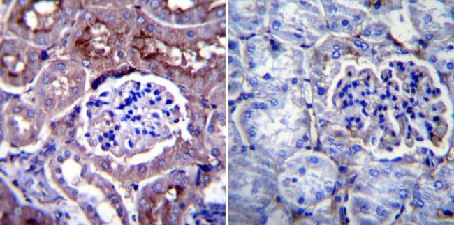 CHRNA1 Antibody in Immunohistochemistry (Paraffin) (IHC (P))