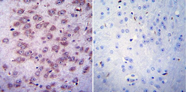 CHRNA1 Antibody in Immunohistochemistry (Paraffin) (IHC (P))