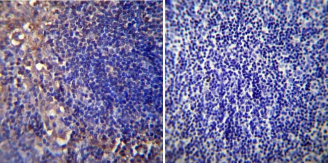 CHRNA1 Antibody in Immunohistochemistry (Paraffin) (IHC (P))