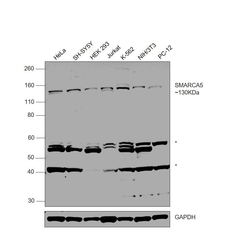 SMARCA5 Antibody in Western Blot (WB)