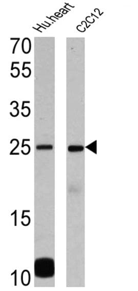 Phospholamban Antibody in Western Blot (WB)