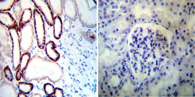 ATP1A1 Antibody in Immunohistochemistry (Paraffin) (IHC (P))