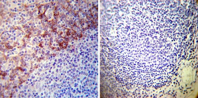 ATP1A1 Antibody in Immunohistochemistry (Paraffin) (IHC (P))