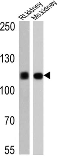 ATP1A1 Antibody in Western Blot (WB)