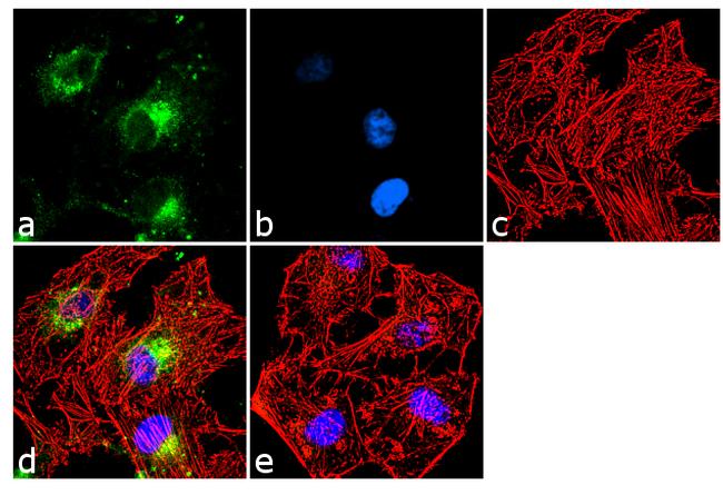 HIP Antibody in Immunocytochemistry (ICC/IF)