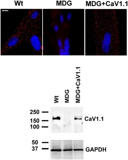 CaV1.1 Antibody in Western Blot (WB)