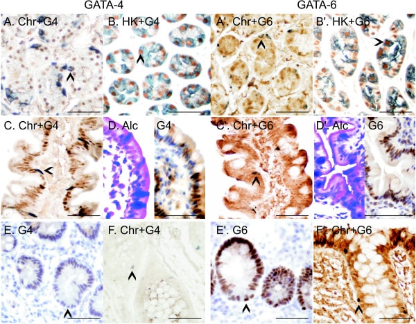 ATP4B Antibody in Immunohistochemistry (IHC)