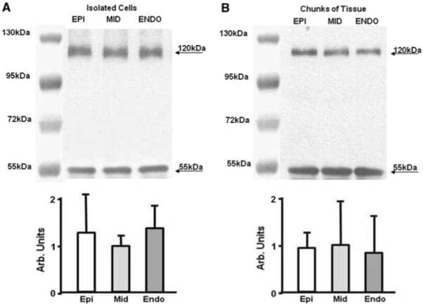 Sodium/Calcium Exchanger Antibody in Western Blot (WB)