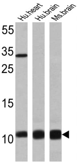 S100 Antibody in Western Blot (WB)