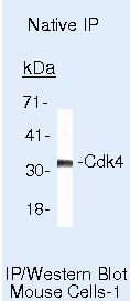 CDK4 Antibody in Immunoprecipitation (IP)
