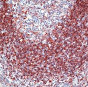 CD79a Antibody in Immunohistochemistry (IHC)