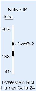 ErbB2 (HER-2) Antibody in Immunoprecipitation (IP)